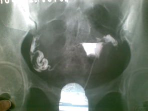 残影小说下载手机版 